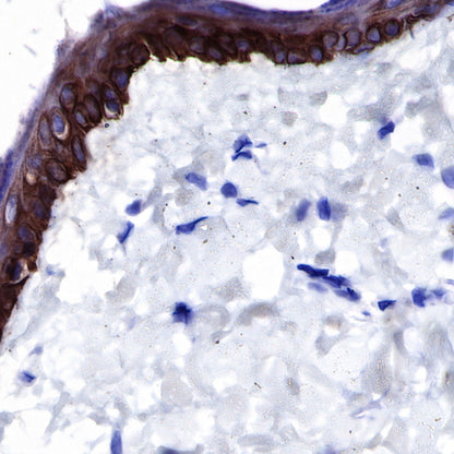 keratin 6 Rabbit mAb (SDT-015-69)