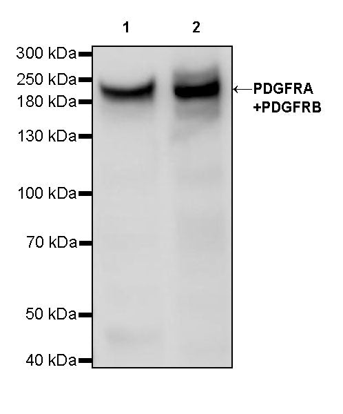PDGFRA+PDGFRB Recombinant Rabbit mAb (S-393-11)
