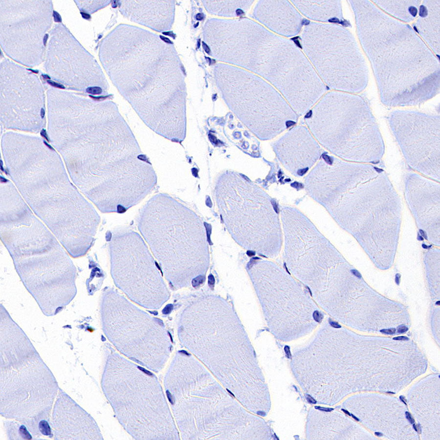 MYBPC3 Recombinant Rabbit mAb (S-5476)