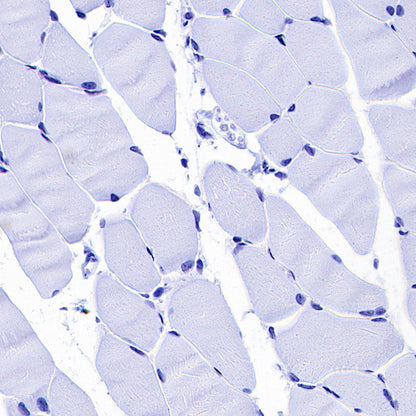 MYBPC3 Recombinant Rabbit mAb (S-5476)