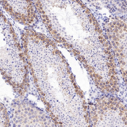 DAZL Recombinant Rabbit mAb (S-3113-35)