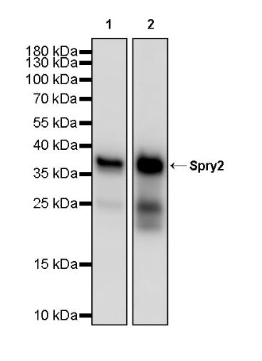 Spry2 Recombinant Rabbit mAb (S-3314-25)