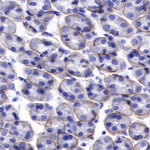 DAG1 Recombinant Mouse mAb (S-R191)
