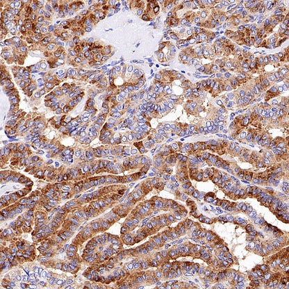 M6PR Recombinant Rabbit mAb (S-2348-14)