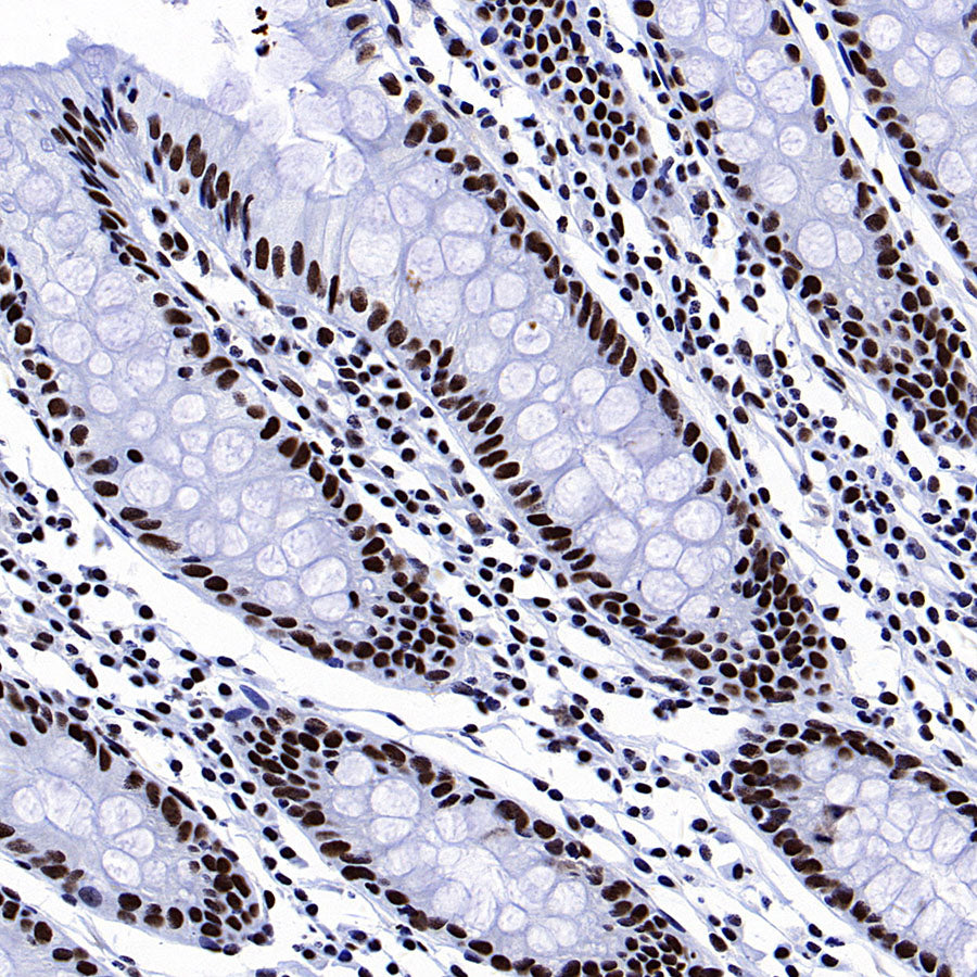 53BP1 Recombinant Rabbit mAb (S-3170-149)