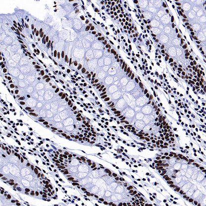 53BP1 Recombinant Rabbit mAb (S-3170-149)