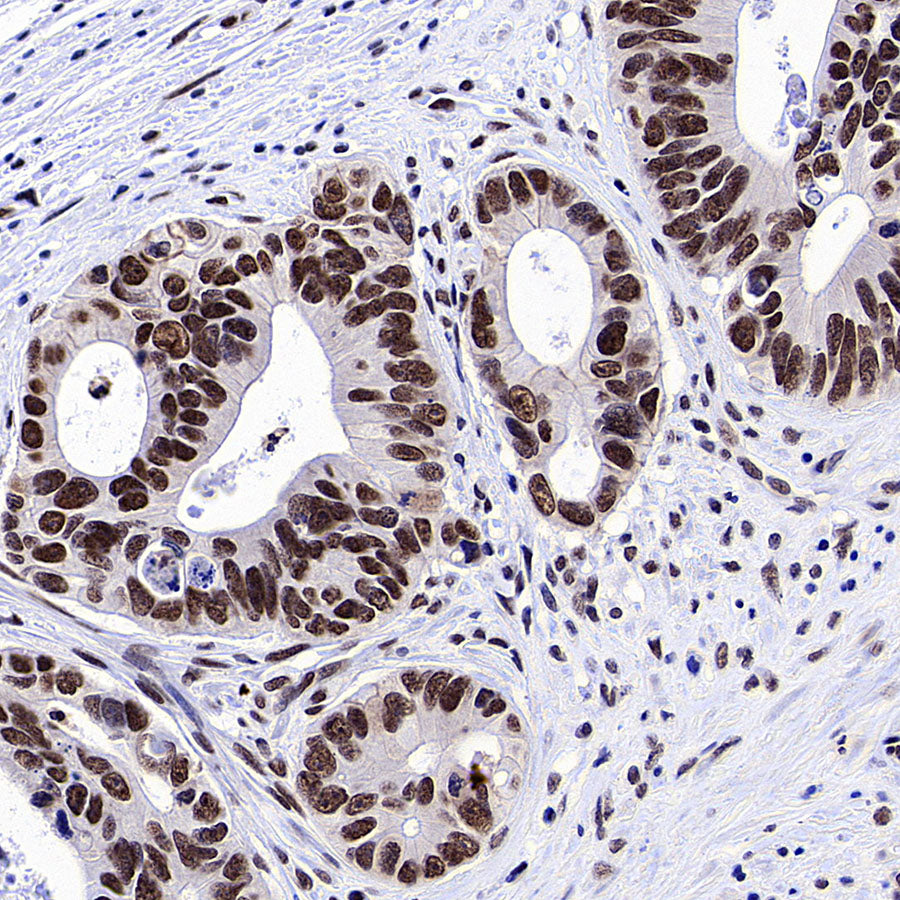 PTBP1 Rabbit Polyclonal Antibody
