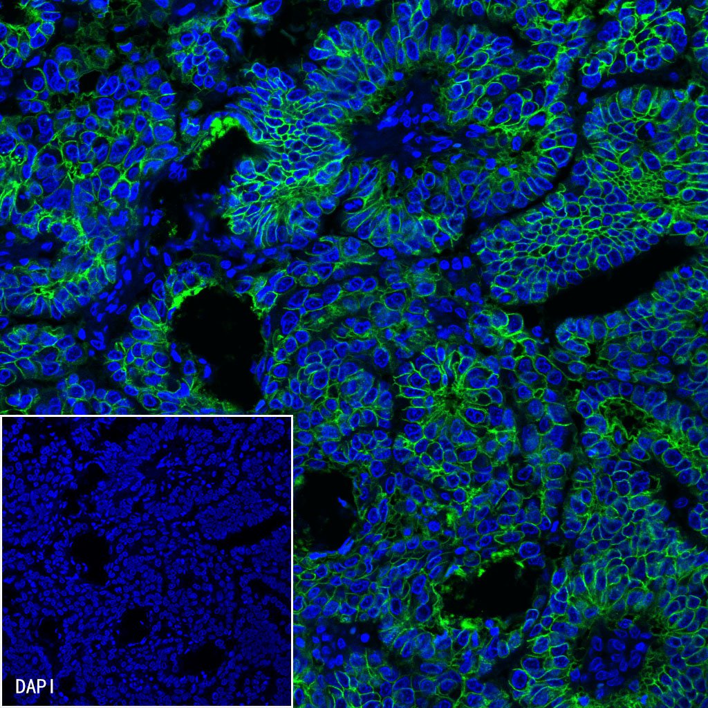 S-RMab® EpCAM Recombinant Rabbit mAb(SDT-078-13)