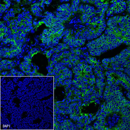 S-RMab® EpCAM Recombinant Rabbit mAb(SDT-078-13)