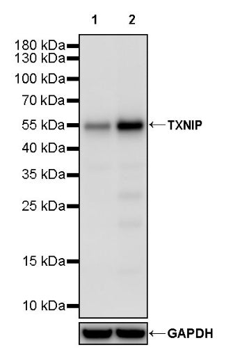 TXNIP Recombinant Rabbit mAb (S-2476-80)