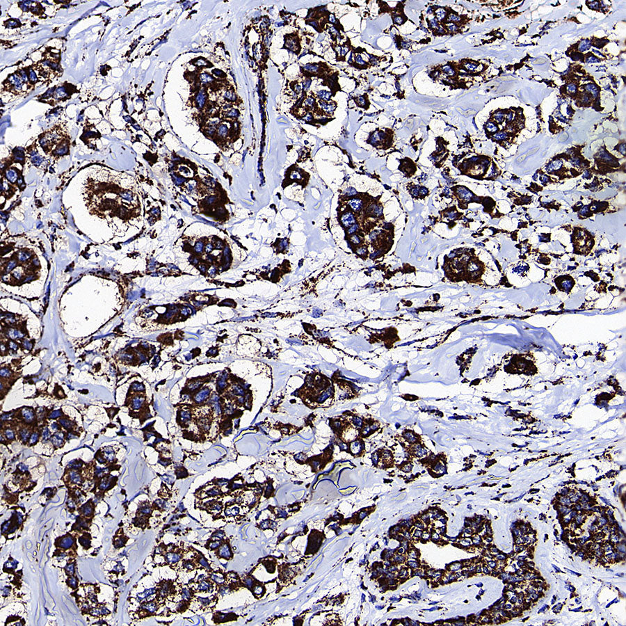 GLUD1 Mouse mAb