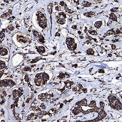 GLUD1 Mouse mAb