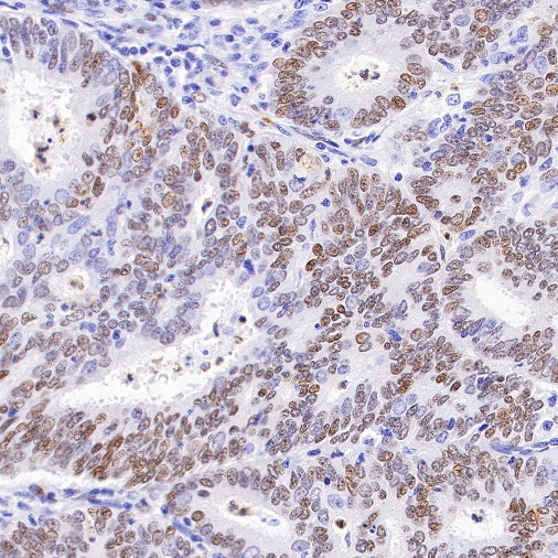 Estrogen Receptor α Recombinant Rabbit mAb (SDT-10001)