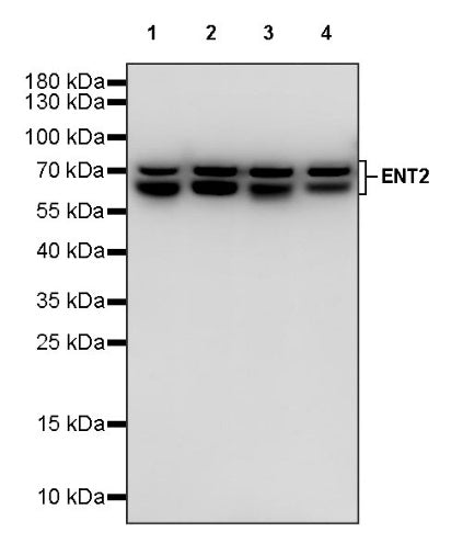 ENT2 Rabbit Polyclonal Antibody