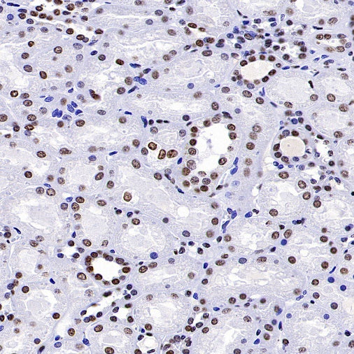 Histone H3 (tri methyl K4) Recombinant Rabbit mAb (S-1602-21)