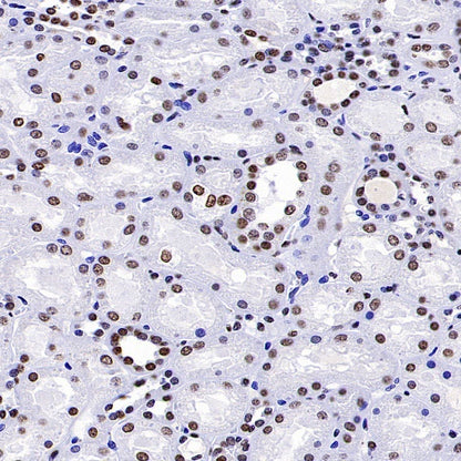 Histone H3 (tri methyl K4) Recombinant Rabbit mAb (S-1602-21)