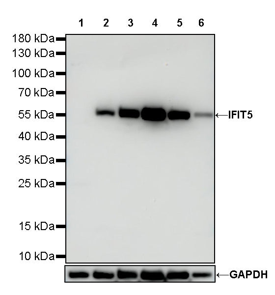 IFIT5 Recombinant Rabbit mAb (S-4213-30)