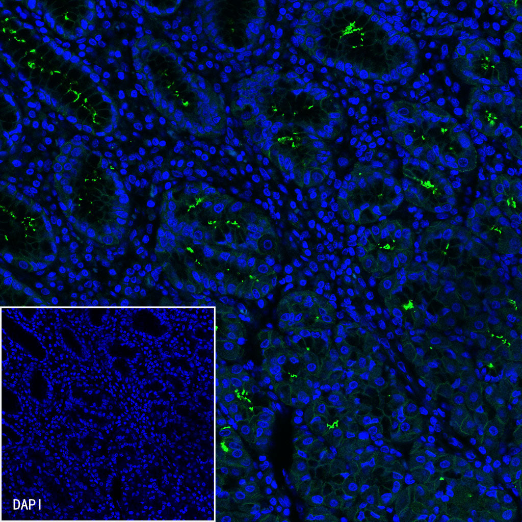 S-RMab® Helicobacter pylori Recombinant Rabbit mAb,PBS Only (SDT-R273)