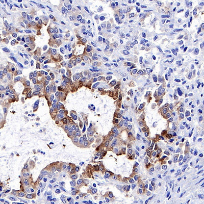IGFBP2 Recombinant Rabbit mAb (S-808-24)