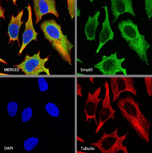 Smyd3 Recombinant Rabbit mAb (S-1507-61)