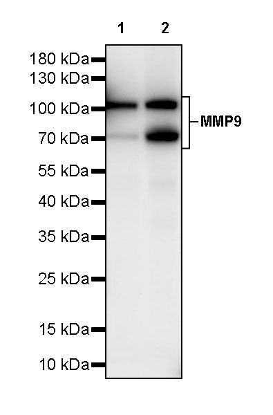 MMP9 Recombinant Rabbit mAb (S-3915-36)