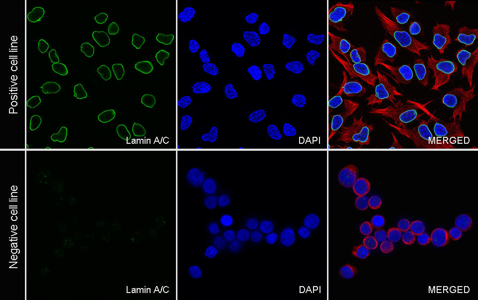 Lamin A/C Recombinant Rabbit mAb (S-5671)