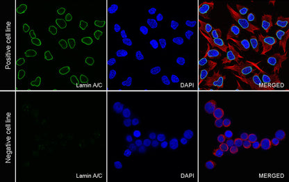 Lamin A/C Recombinant Rabbit mAb (S-5671)