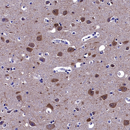 p35/25 Recombinant Rabbit mAb (S-2719-47)