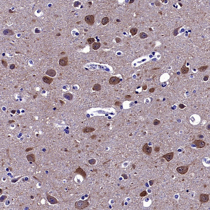 p35/25 Recombinant Rabbit mAb (S-2719-47)