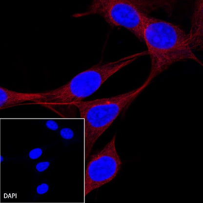 β-tubulin Recombinant Rabbit mAb (Alexa Fluor®555 Conjugate) (S-312-113)