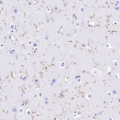 TMEM119 Recombinant Rabbit mAb (S-1040-14)