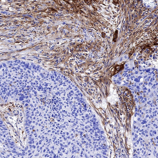ICAM-1/CD54 Recombinant Rabbit mAb (S-906-48)