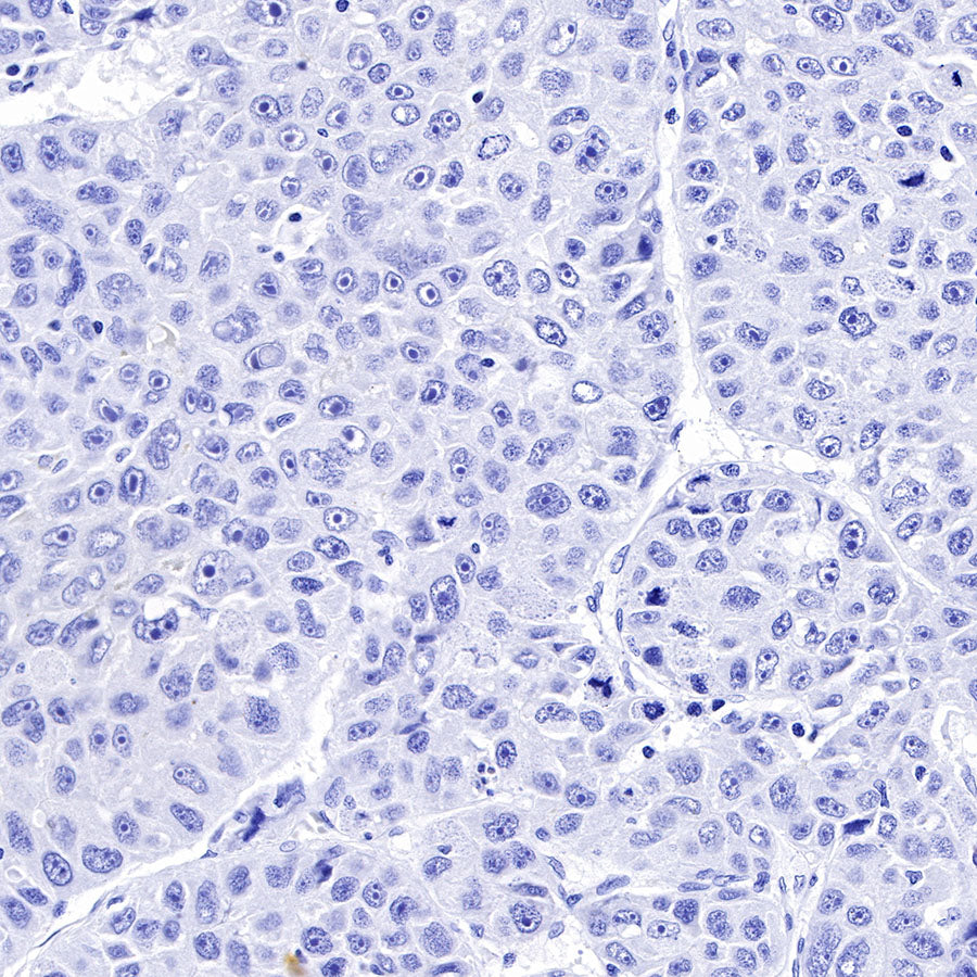 OCT3/4 Recombinant Rabbit mAb (SDT-165-76)