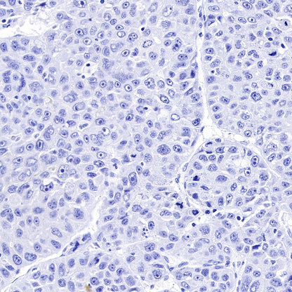 OCT3/4 Recombinant Rabbit mAb (SDT-165-76)