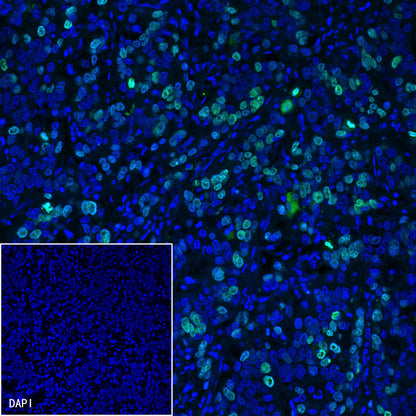 S-RMab® Ki67 Recombinant Rabbit mAb (SDT-R459)