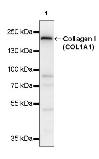 S-RMab® Collagen I (COL1A1) Recombinant Rabbit mAb (S-463-3)