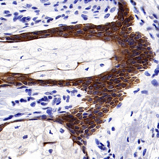 Cytokeratin 6A (KRT6A) Recombinant Mouse mAb (SDT-3380)