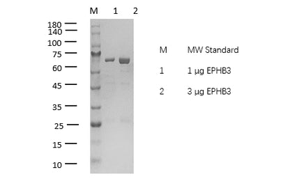 EPHB3 Protein