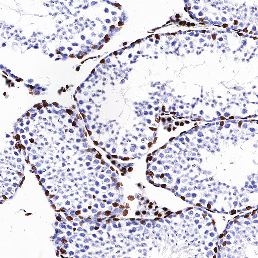Androgen Receptor Recombinant Rabbit mAb (SDT-R157)