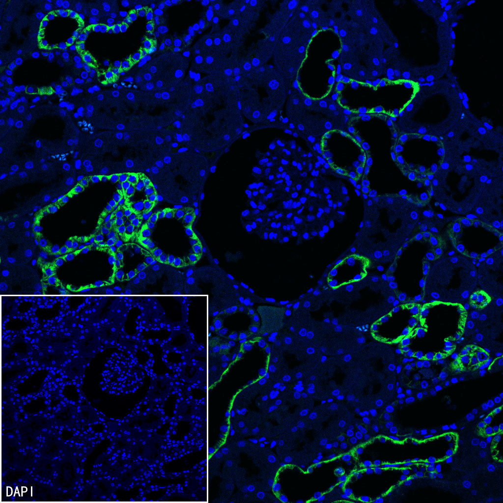 BSND Recombinant Rabbit mAb (S-3815-70)