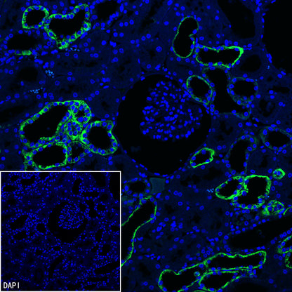 BSND Recombinant Rabbit mAb (S-3815-70)