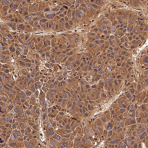 PLCG1 Recombinant Rabbit mAb (S-978-37)