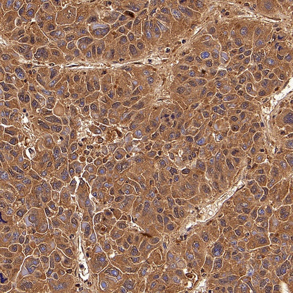 PLCG1 Recombinant Rabbit mAb (S-978-37)