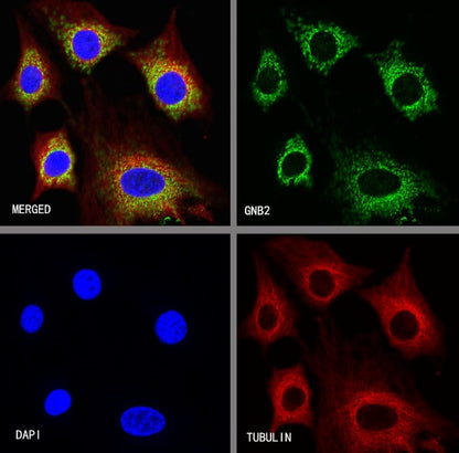 GNB2 Recombinant Rabbit mAb (S-645-10)