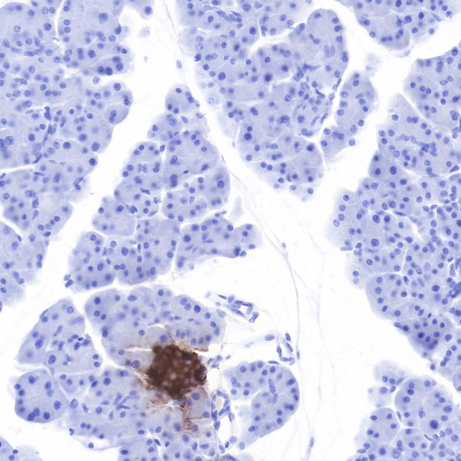 Insulin Recombinant Rabbit mAb (SDT-026-17)