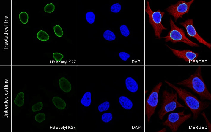 Histone H3 (acetyl K27) Rabbit pAb