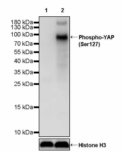 Phospho-YAP (Ser127) Recombinant Rabbit mAb (S-4250)
