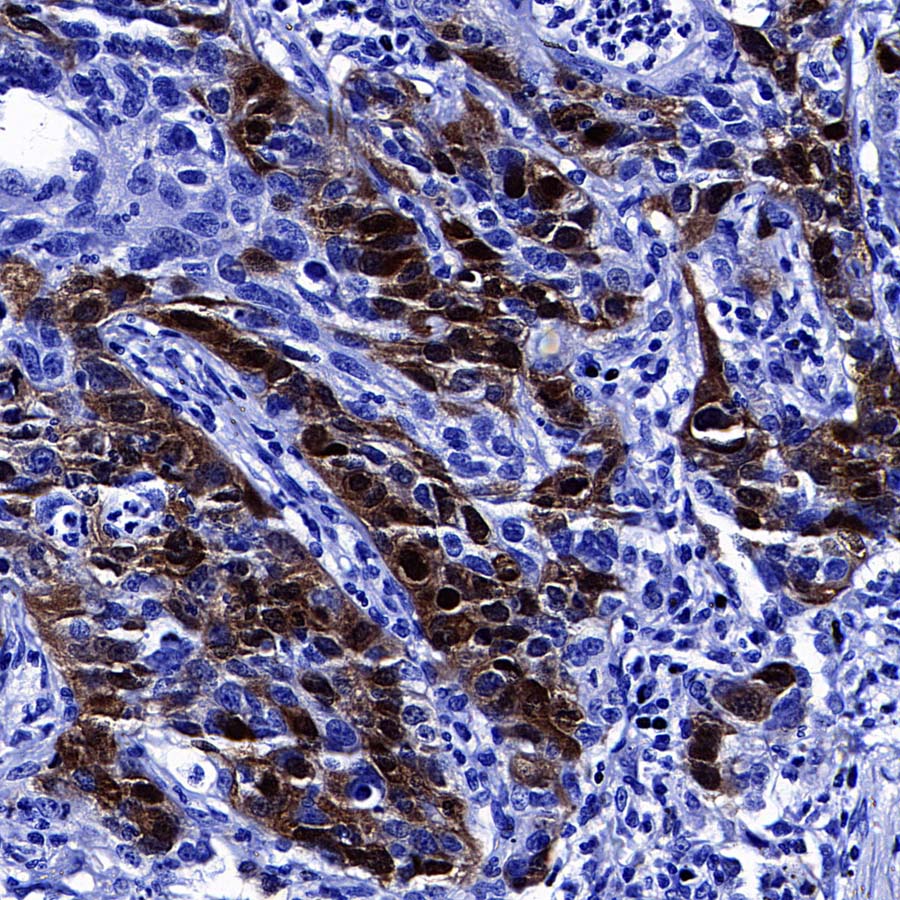 Thymidine Kinase 1 Recombinant Rabbit mAb (S-4127-43)