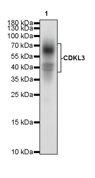 CD64 Recombinant Mouse mAb (S-5504)