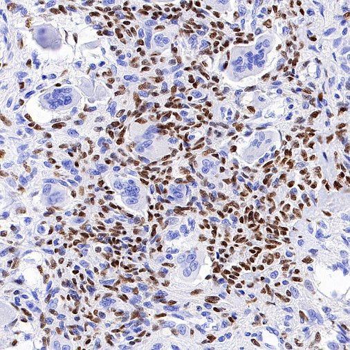 Histone H3.3 G34W Recombinant Rabbit mAb (SDT-6018)
